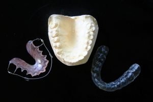 Как 3D-печать революционизирует медицину: 4 ключевых применения и будущие тренды