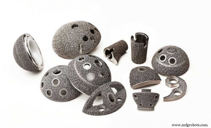 Революция в костных имплантах: как 3D-печать улучшает прилегание, долговечность и эффективность