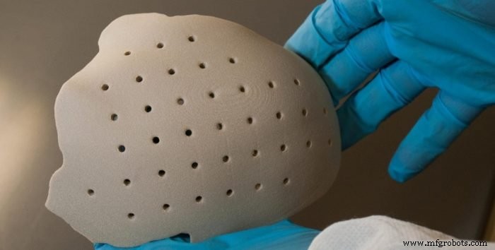 Революция в костных имплантах: как 3D-печать улучшает прилегание, долговечность и эффективность